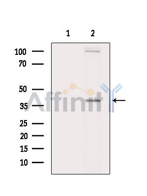 TASP1 Antibody - Western blot analysis of extracts from HepG2 cells(heat-shock treatment), using TASP1 Antibody.