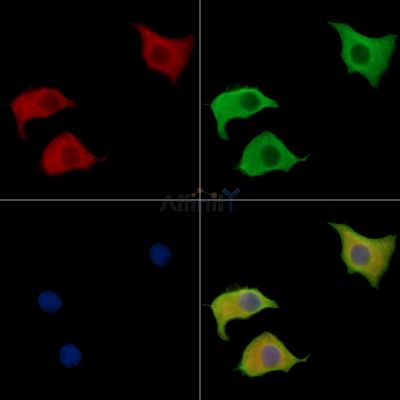 TASP1 Antibody - DF15665 staining HepG2 cells by IF/ICC.