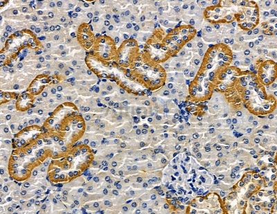 PSG9 Antibody - DF15673 at 1/100 staining mouse kidney tissue by IHC-P.