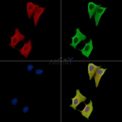 SLC15A4 Antibody - DF15674 staining HepG2 cells by IF/ICC.