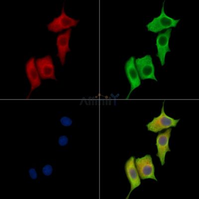 RPN2 Antibody - DF15676 staining HepG2 cells by IF/ICC.