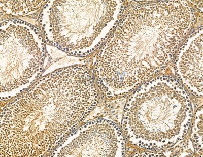 RPN2 Antibody - DF15676 at 1/100 staining rat testis tissue by IHC-P.