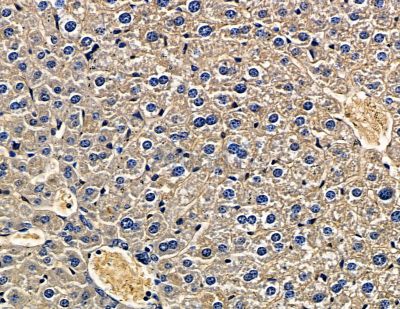 SLITRK2 Antibody - DF15697 at 1/100 staining mouse liver tissue by IHC-P.