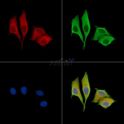 SLITRK2 Antibody - DF15697 staining HepG2 cells by IF/ICC.