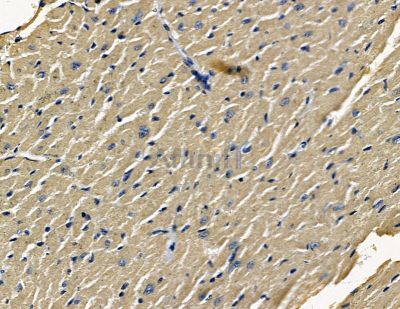 SLITRK4 Antibody - DF15699 at 1/100 staining mouse heart tissue by IHC-P.