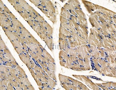 SLITRK4 Antibody - DF15699 at 1/100 staining rat muscle tissue by IHC-P.