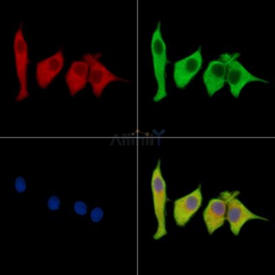 SLITRK4 Antibody - DF15699 staining HepG2 cells by IF/ICC.
