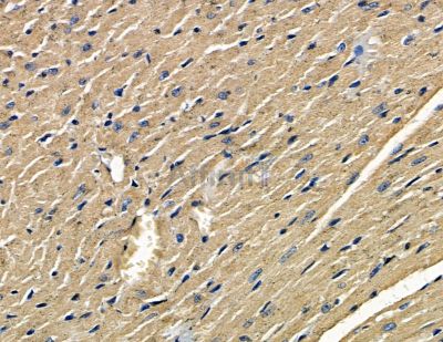 RC3H1 Antibody - DF15706 at 1/100 staining mouse heart tissue by IHC-P.