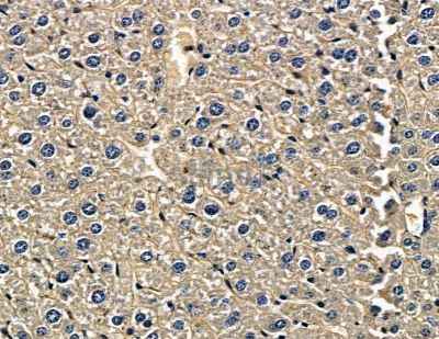 RC3H1 Antibody - DF15706 at 1/100 staining mouse liver tissue by IHC-P.