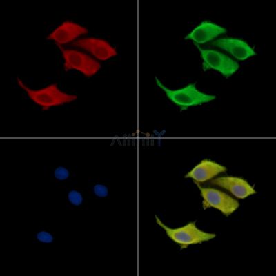 RC3H1 Antibody - DF15706 staining HepG2 cells by IF/ICC.