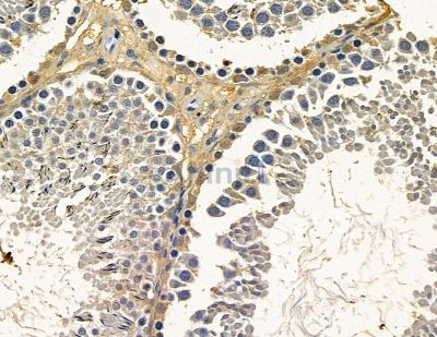 DHX37 Antibody - DF15715 at 1/100 staining rat testis tissue by IHC-P.