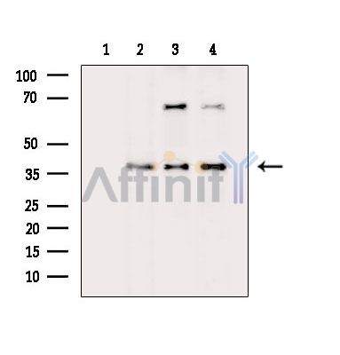 FCN1 Antibody - Western blot analysis of extracts from various samples, using FCN1 Antibody.