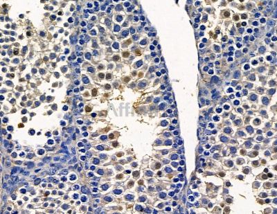 DDX28 Antibody - DF15718 at 1/100 staining mouse testis tissue by IHC-P.