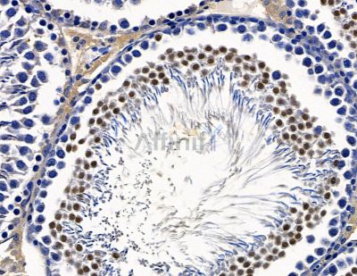ZBTB7B Antibody - DF15722 at 1/100 staining rat testis tissue by IHC-P.