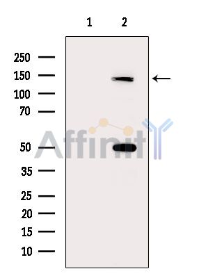 FNDC3A Antibody - Western blot analysis of extracts from Hela cells(heat-shock treatment), using FNDC3A Antibody.