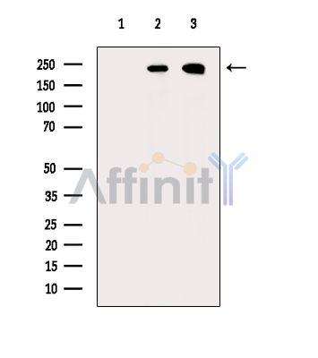 PPL Antibody - Western blot analysis of extracts from various samples, using PPL Antibody.