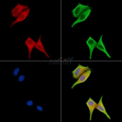 TREML2 Antibody - DF15746 staining HepG2 cells by IF/ICC.