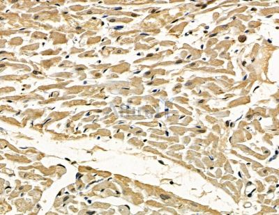 FAM13C Antibody - DF15755 at 1/100 staining rat heart tissue by IHC-P.