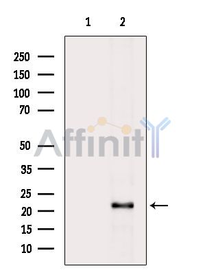 CLEC2A Antibody - Western blot analysis of extracts from Rat liver, using CLEC2A Antibody.