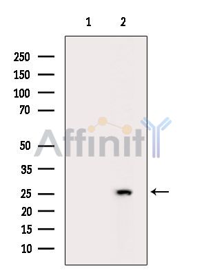 PRTFDC1 Antibody - Western blot analysis of extracts from Hela cells(heat-shock treatment), using PRTFDC1 Antibody.