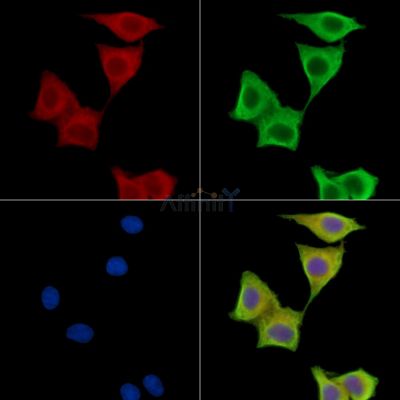 MARCH5 Antibody - DF15768 staining HepG2 cells by IF/ICC.