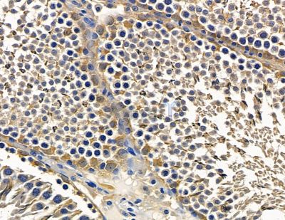 TOM1L1 Antibody - DF15773 at 1/100 staining rat testis tissue by IHC-P.