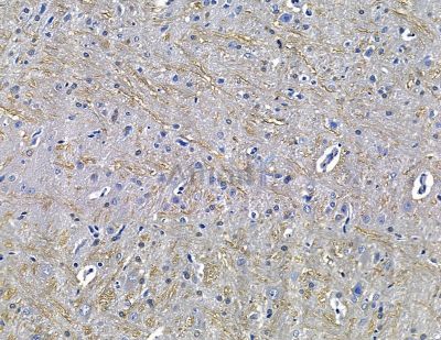 HILPDA Antibody - DF15774 at 1/100 staining rat brain tissue by IHC-P.
