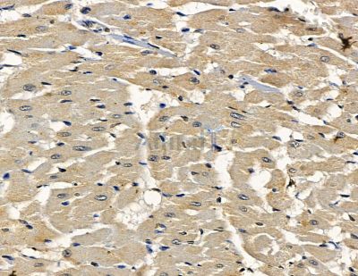 DACT3 Antibody - DF15777 at 1/100 staining rat heart tissue by IHC-P.