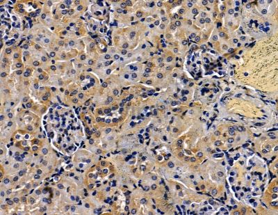 METTL7A Antibody - DF15781 at 1/100 staining mouse kidney tissue by IHC-P.