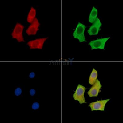 METTL7A Antibody - DF15781 staining HepG2 cells by IF/ICC.