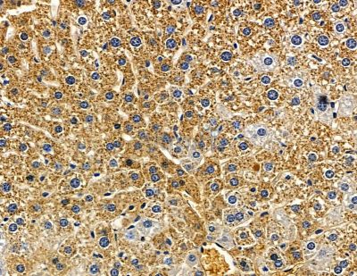TRAT1 Antibody - DF15785 at 1/100 staining mouse liver tissue by IHC-P.