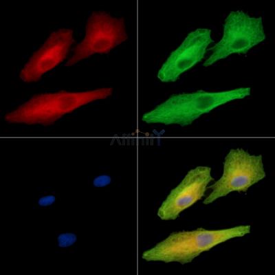 AKAP7 Antibody - DF15787 staining A549 cells by IF/ICC.