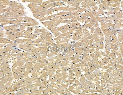 RMND5B Antibody - DF15791 at 1/100 staining rat heart tissue by IHC-P.