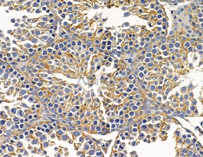 ARMS2 Antibody - DF15793 at 1/100 staining mouse testis tissue by IHC-P.