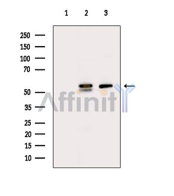 PLAG1 Antibody - Western blot analysis of extracts from various samples, using PLAG1 Antibody.
