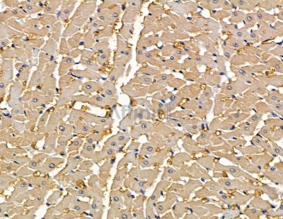 C2CD5 Antibody - DF15801 at 1/100 staining rat heart tissue by IHC-P.