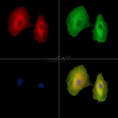 TSPAN6 Antibody - DF15805 staining A549 cells by IF/ICC.