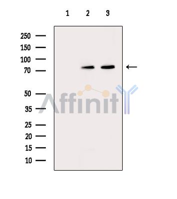 ANO10 Antibody - Western blot analysis of extracts from various samples, using ANO10 Antibody.