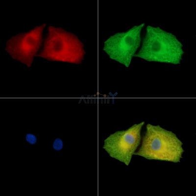 ANO10 Antibody - DF15809 staining A549 cells by IF/ICC.