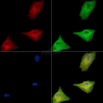 TMTC1 Antibody - DF15818 staining A549 cells by IF/ICC.