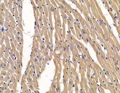 ABI3 Antibody - DF15821 at 1/100 staining rat heart tissue by IHC-P.