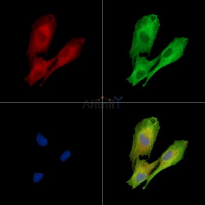 DOLPP1 Antibody - DF15823 staining A549 cells by IF/ICC.