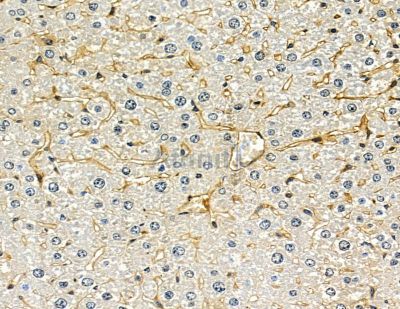 DOLPP1 Antibody - DF15823 at 1/100 staining mouse liver tissue by IHC-P.