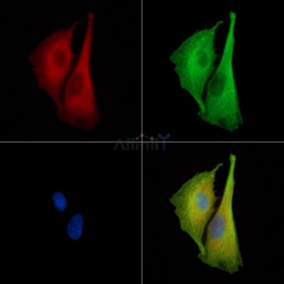 BRPF3 Antibody - DF15825 staining A549 cells by IF/ICC.