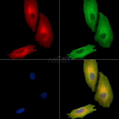 KIAA1958 Antibody - DF15828 staining A549 cells by IF/ICC.