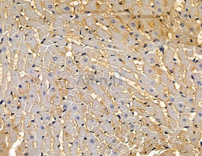 KIAA1958 Antibody - DF15828 at 1/100 staining rat heart tissue by IHC-P.
