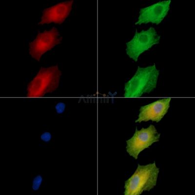 PLEKHH2 Antibody - DF15829 staining A549 cells by IF/ICC.