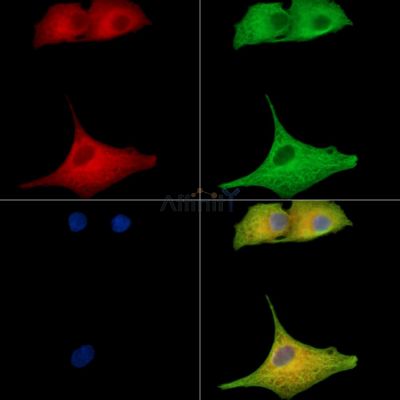 CLVS1 Antibody - DF15830 staining A549 cells by IF/ICC.