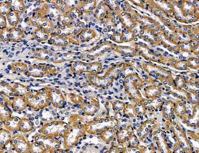 CLVS1 Antibody - DF15830 at 1/100 staining mouse kidney tissue by IHC-P.
