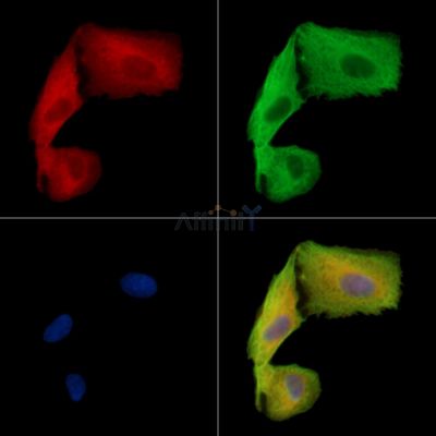 TSPAN10 Antibody - DF15833 staining A549 cells by IF/ICC.